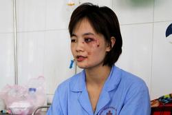 Nữ phụ xe bị 5 thanh niên đánh nhập viện: ‘Tôi tủi thân và ám ảnh’