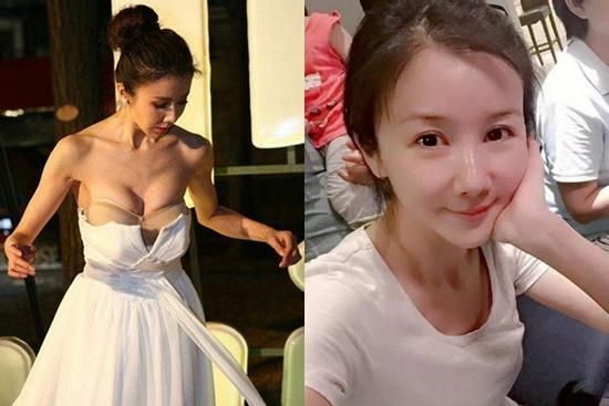 'Thảm họa tụt ngực' từ ngôi vị tượng đài nhan sắc cổ trang Cbiz đến tan tành sự nghiệp vì thẩm mỹ và scandal