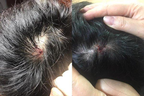 Nam thần tượng 18 tuổi xứ Hàn đăng ảnh ám chỉ tự tử sau scandal bạo hành-3