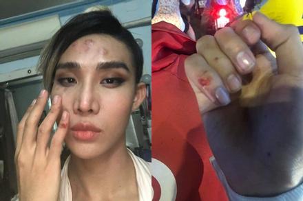 Học trò Thanh Hằng bị tài xế xe ôm công nghệ đánh sứt đầu mẻ trán