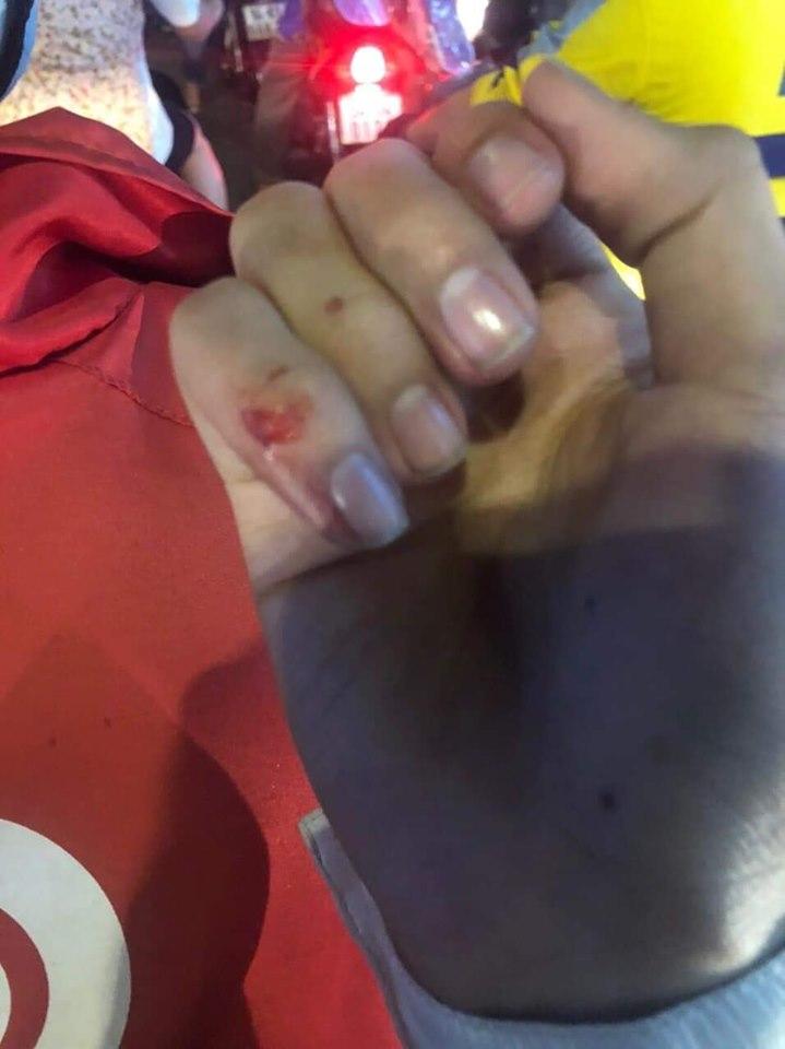 Học trò Thanh Hằng bị tài xế xe ôm công nghệ đánh sứt đầu mẻ trán-4