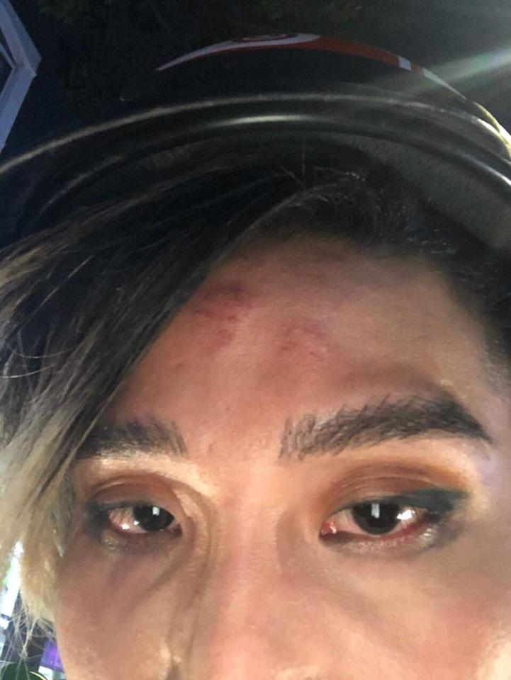 Học trò Thanh Hằng bị tài xế xe ôm công nghệ đánh sứt đầu mẻ trán-3