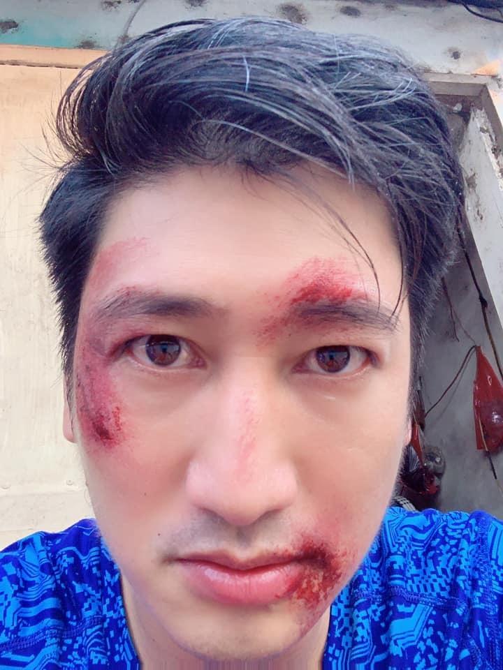 Cái kết của Thái Hoa hồng trên ngực trái sẽ làm khán giả thoả mãn-2