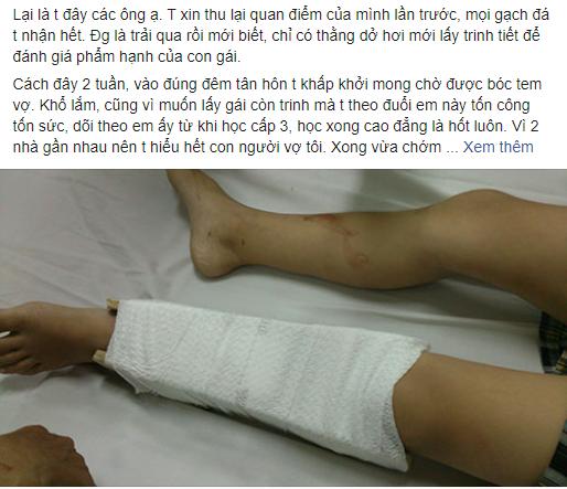 Vỗ ngực lấy được vợ còn trinh nhưng ngay trong đêm tân hôn, anh chồng phát hiện sự thật cay đắng-1