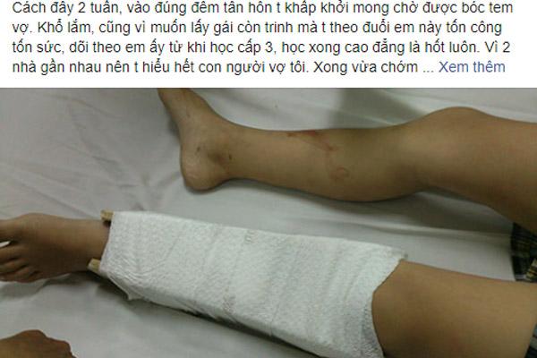 Đến khách sạn tìm bạn trai soái ca, tôi tương kế tựu kế diễn kịch hay khiến anh cứng họng-3