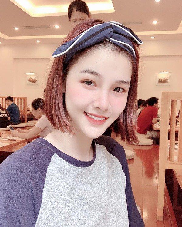 Sau nhiều tháng dao kéo, Kỳ Hân vẫn bị dân tình chê bai khuôn mặt thua xa quá khứ-5