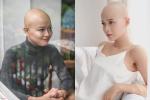 Nữ sinh ĐH Ngoại thương: ‘Không nghĩ ung thư đến khi mới 19 tuổi’