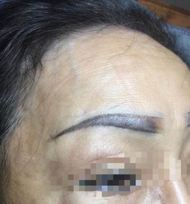 TP.HCM: Sau khi xăm chân mày, một người phụ nữ lâm vào tình trạng nguy kịch-1