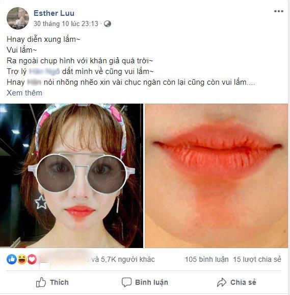 Hari Won đăng ảnh cận mặt đầy rạng rỡ, CĐM nhanh chóng soi vết kì lạ dưới đôi môi-6