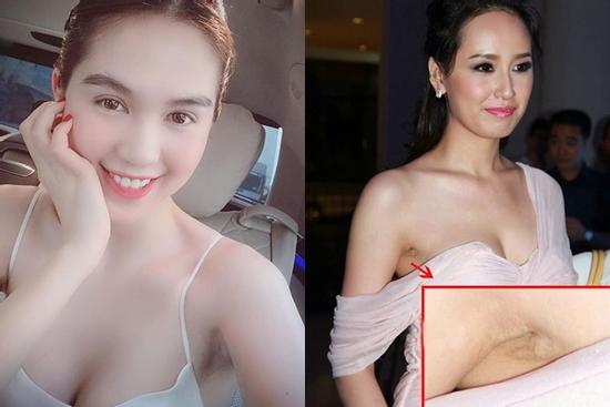 Da dẻ trắng ngần nhưng vùng nách thâm sì, chắc là Ngọc Trinh chưa biết bí quyết này