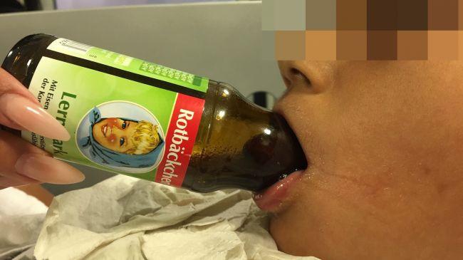 Cậu bé 7 tuổi phải nhập viện vì lưỡi mắc kẹt trong cổ chai-1