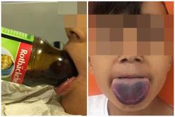 Cậu bé 7 tuổi phải nhập viện vì lưỡi mắc kẹt trong cổ chai
