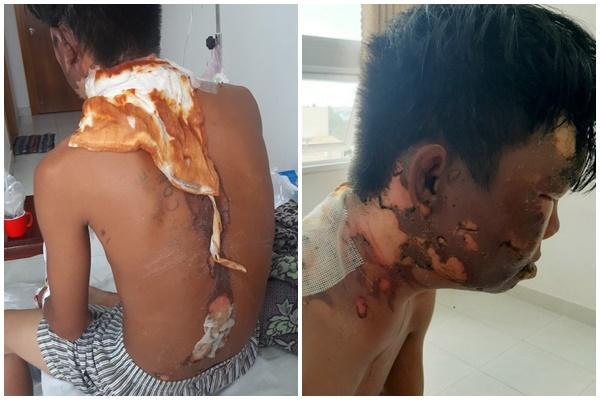 Tiết lộ bất ngờ của ông bố có con gái tưới nước sôi lên người con trai-3