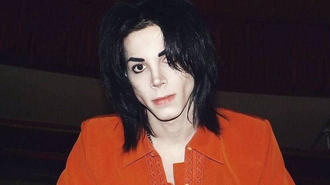 Người hâm mộ chi 30.000 USD để phẫu thuật thành Michael Jackson-4