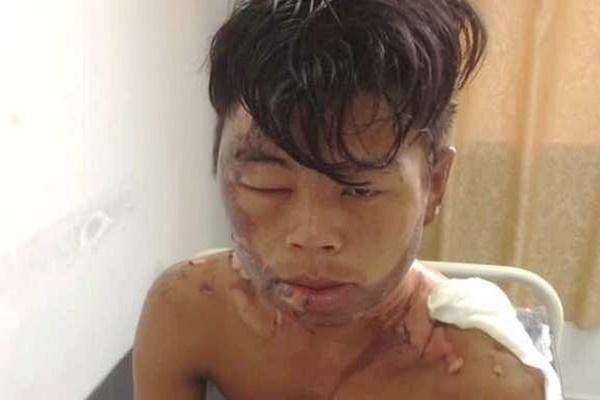 Người mẹ ở Vĩnh Long chứng kiến con trai bị chị gái tạt nước sôi lên đầu-3