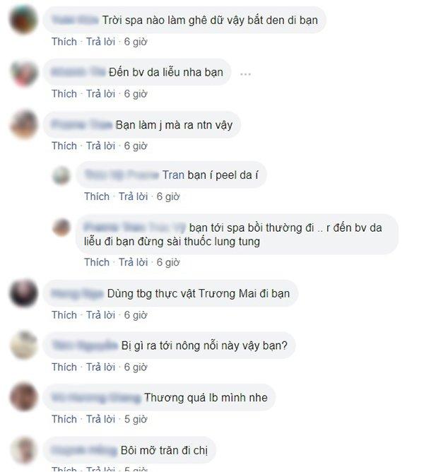 Khóc thét trước những gương mặt bị bỏng nặng sau khi lột da-2