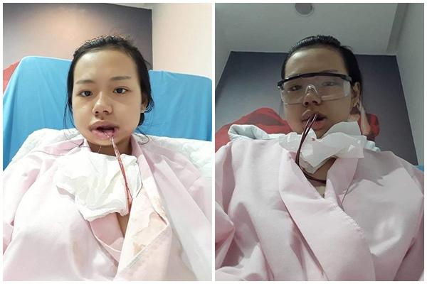 Bị bạn học trêu chọc là xấu xí, cô gái đợi đến 19 tuổi để phẫu thuật thẩm mỹ thành hot girl-2