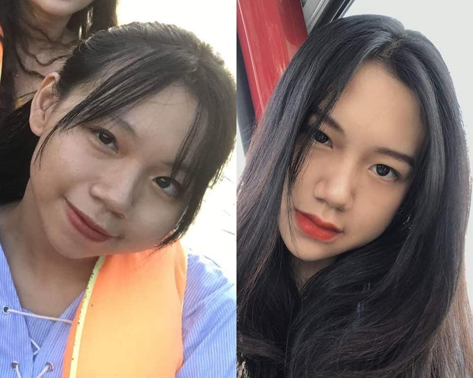 Bị bạn học trêu chọc là xấu xí, cô gái đợi đến 19 tuổi để phẫu thuật thẩm mỹ thành hot girl-4