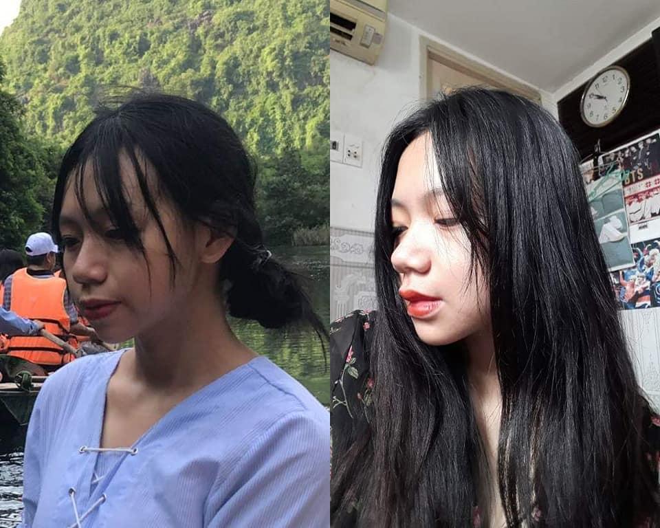 Bị bạn học trêu chọc là xấu xí, cô gái đợi đến 19 tuổi để phẫu thuật thẩm mỹ thành hot girl-6