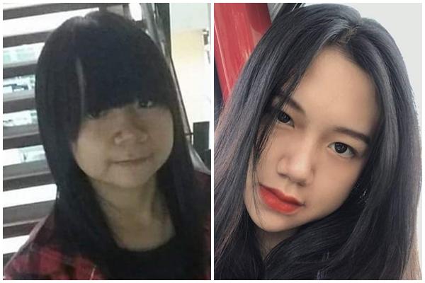 Chàng trai chi chít mụn mủ khắp mặt và người sau khi dùng thuốc nam bán trên mạng xã hội-3