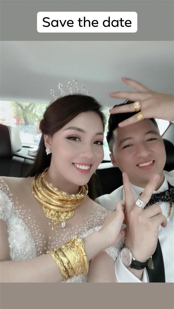 Au Ha My Lộ 3 Vong Nảy Nở Sau 1 Thang Lấy Chồng