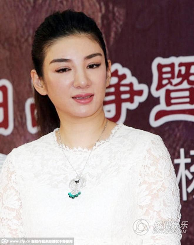 Chỉ vì phẫu thuật thẩm mỹ, loạt mỹ nhân Hoa ngữ lâm cảnh lao dốc từ ngoại hình tới sự nghiệp-18