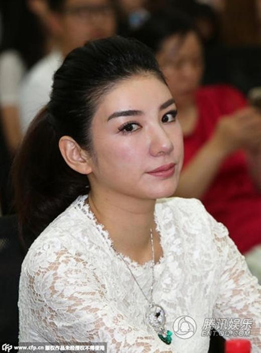 Chỉ vì phẫu thuật thẩm mỹ, loạt mỹ nhân Hoa ngữ lâm cảnh lao dốc từ ngoại hình tới sự nghiệp-19