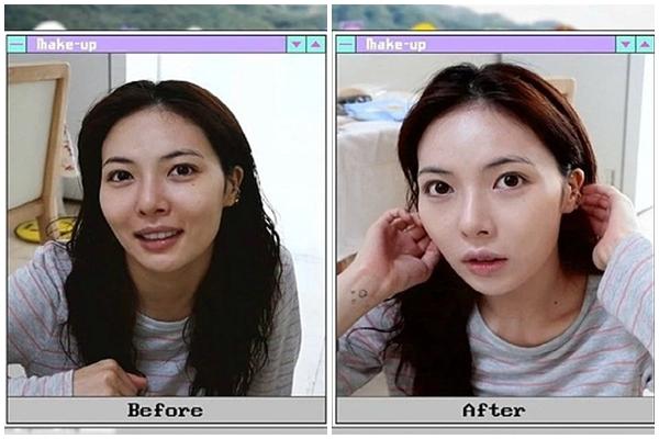 HyunA lần đầu chia sẻ về bệnh tật-4