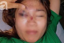TP.HCM: Một phụ nữ 28 tuổi ngưng tim, ngưng thở nghi do sốc phản vệ khi chuẩn bị sửa mũi tại thẩm mỹ viện