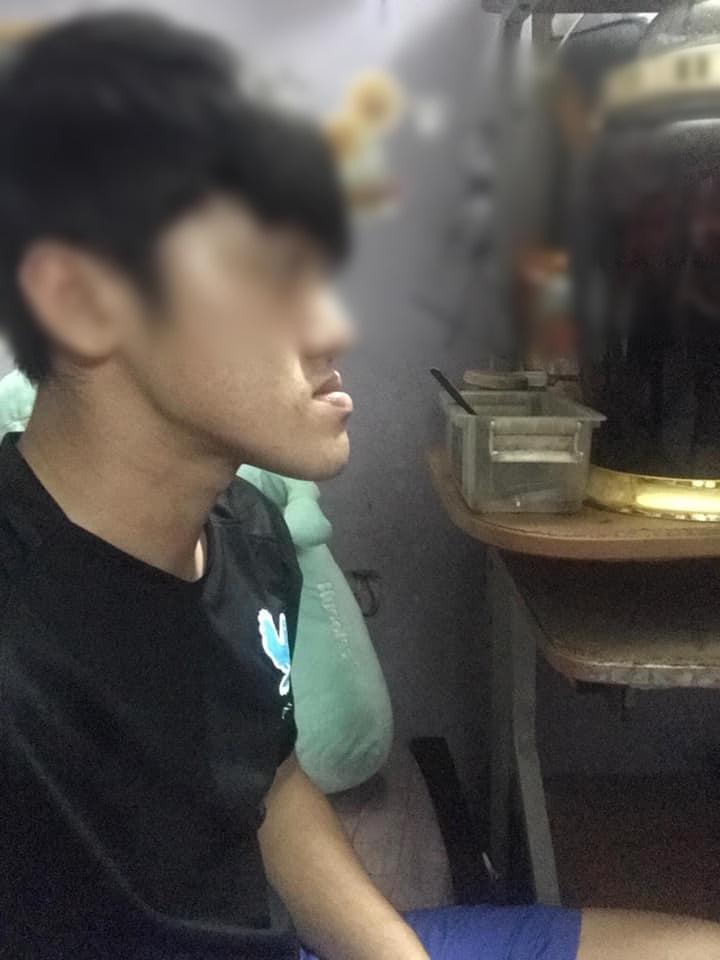 Sức mạnh vi diệu của phẫu thuật thẩm mỹ: Biến chàng trai cằm nhô dài ra phía trước trở thành soái ca-1