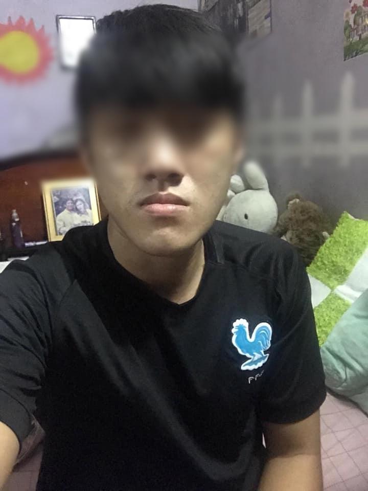 Sức mạnh vi diệu của phẫu thuật thẩm mỹ: Biến chàng trai cằm nhô dài ra phía trước trở thành soái ca-3