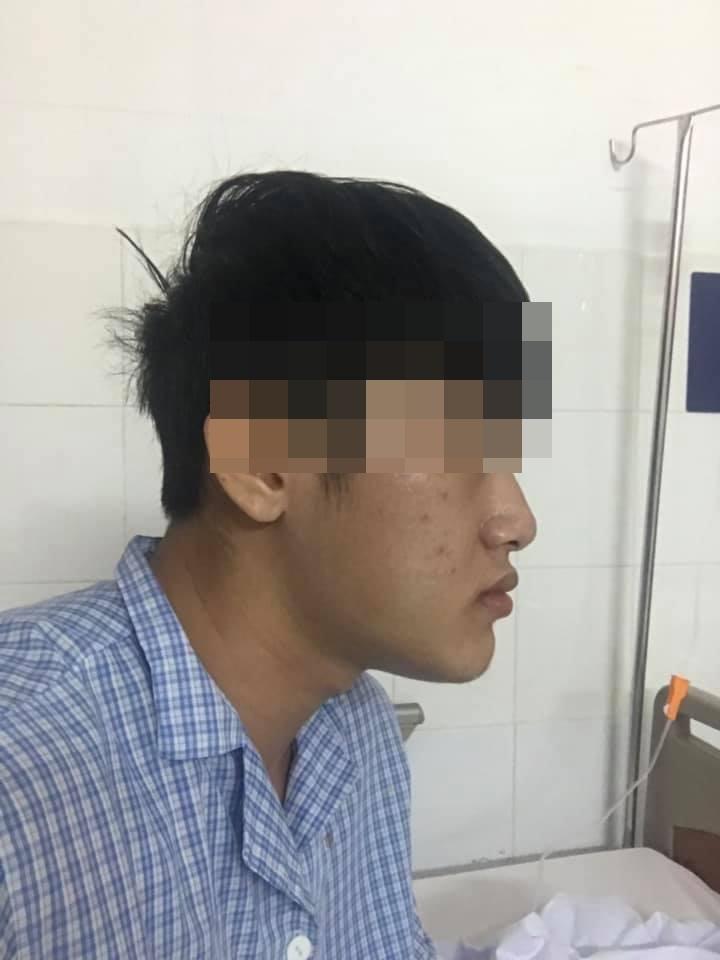 Sức mạnh vi diệu của phẫu thuật thẩm mỹ: Biến chàng trai cằm nhô dài ra phía trước trở thành soái ca-5