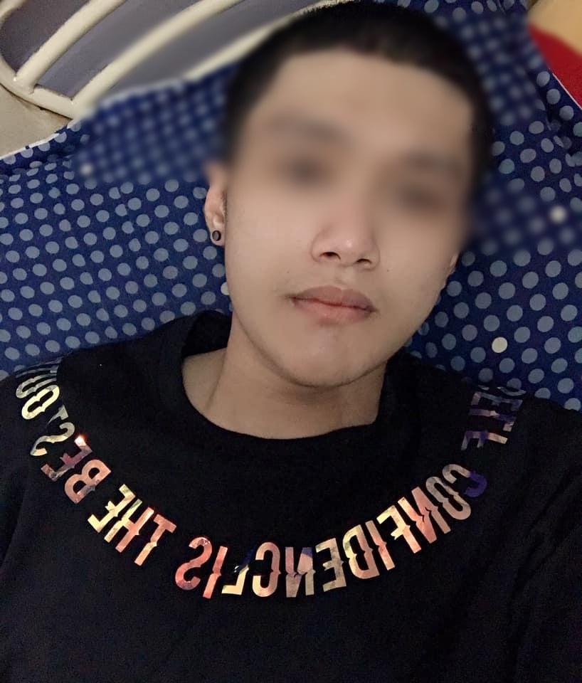 Sức mạnh vi diệu của phẫu thuật thẩm mỹ: Biến chàng trai cằm nhô dài ra phía trước trở thành soái ca-7