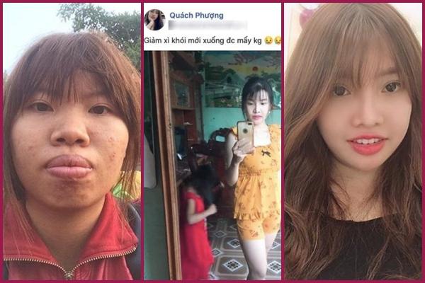 Đến spa biến Thị Nở thành công chúa, cô gái ở TPHCM tai biến nặng-5