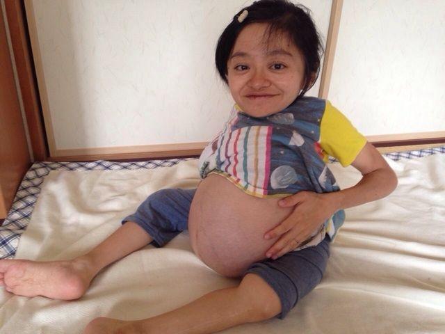 Người phụ nữ chỉ cao 100cm và nặng 20kg nhưng nhìn con sinh ra ai cũng bất ngờ-2