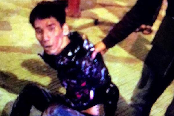 Hà Nội: Người phụ nữ 48 tuổi hứng cơn mưa dao từ thanh niên lạ mặt-2