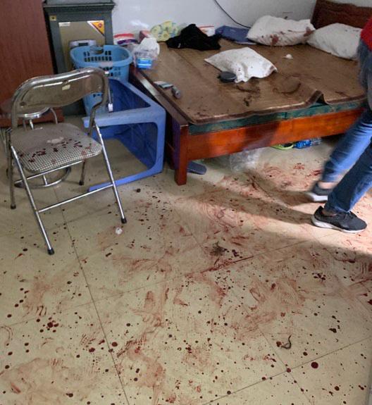 Hà Nội: Người phụ nữ 48 tuổi hứng cơn mưa dao từ thanh niên lạ mặt-1