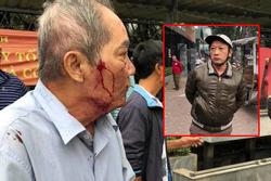 Clip: Cụ ông 80 tuổi bị gã xe ôm dùng súng cao su bắn vào mặt vì 'tranh giành địa bàn' ở Hà Nội