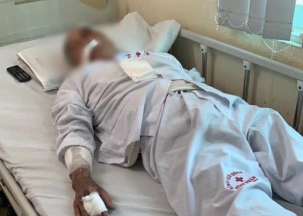 Clip: Cụ ông 80 tuổi bị gã xe ôm dùng súng cao su bắn vào mặt vì tranh giành địa bàn ở Hà Nội-3