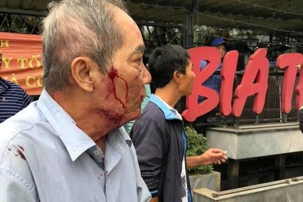 Clip: Cụ ông 80 tuổi bị gã xe ôm dùng súng cao su bắn vào mặt vì tranh giành địa bàn ở Hà Nội-1