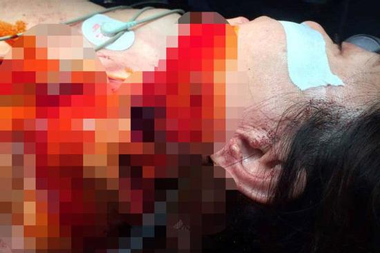 Mâu thuẫn gia đình, chồng giết vợ rồi cắt cổ tự sát?