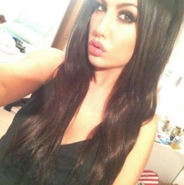 Môi 9X sưng phồng, bị sẹo vĩnh viễn vì tiêm filler giá rẻ-1