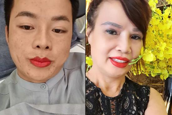 Cô dâu 62 tuổi 'nổi lửa' MXH khi livestream xăm môi cùng chồng 26 nhưng thành quả mới là thứ đáng bàn