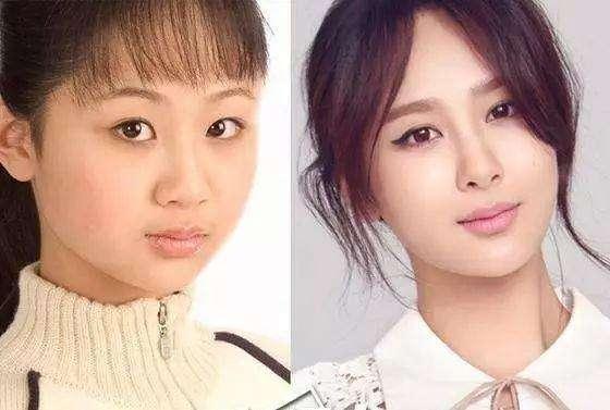 Nữ hoàng rating Dương Tử chính thức lên tiếng về loạt ảnh tới bệnh viện thẩm mỹ-6