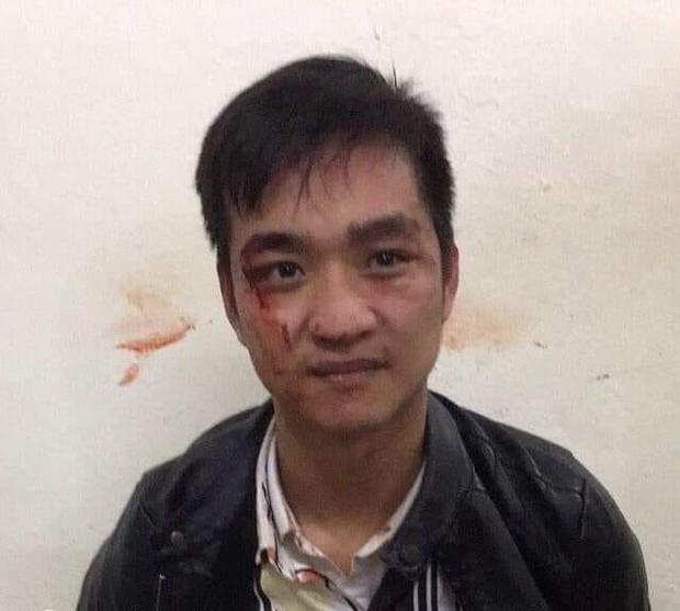 Hà Nội: Cướp tiệm vàng, nam thanh niên bị công an tóm gọn-1