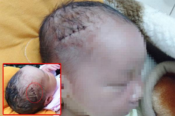 Bé sơ sinh 4,1kg bị bác sĩ kéo đứt dây chằng cánh tay, bác sĩ vẫn nói Đó là sự cố y khoa, ở đâu cũng có-4