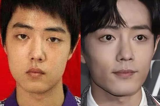 Sau Vương Nhất Bác, Tiêu Chiến cũng vướng nghi án phẫu thuật thẩm mỹ