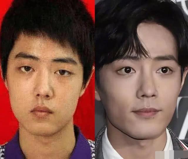 Sau Vương Nhất Bác, Tiêu Chiến cũng vướng nghi án phẫu thuật thẩm mỹ-3