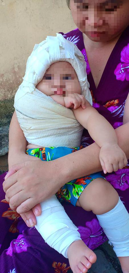 Bé sơ sinh 4,1kg bị bác sĩ kéo đứt dây chằng cánh tay, bác sĩ vẫn nói Đó là sự cố y khoa, ở đâu cũng có-3