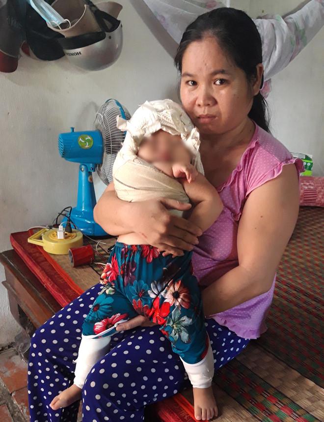 Bé sơ sinh 4,1kg bị bác sĩ kéo đứt dây chằng cánh tay, bác sĩ vẫn nói Đó là sự cố y khoa, ở đâu cũng có-2